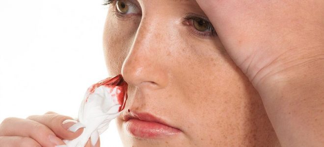 Частые кровотечения из носа у взрослого причины